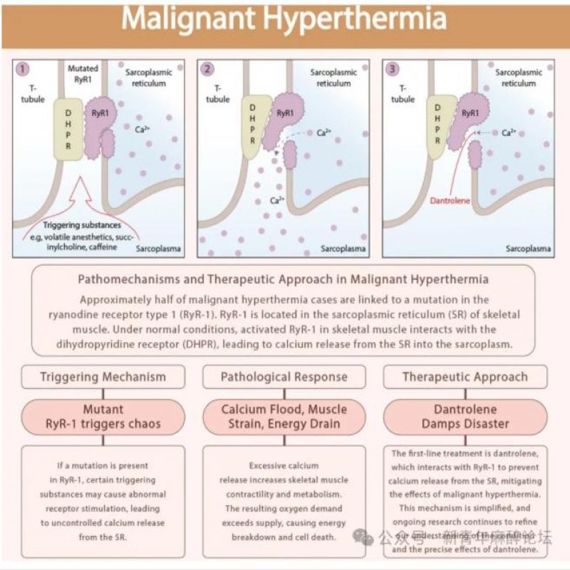 一例亲属活体肾移植术的特殊麻醉：直面恶性高热与心功能不全双重难题